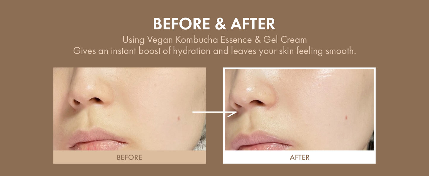 Vegan Kombucha Cream Essence, Cruelty FreeㅣThe most Effective all-in-one serum