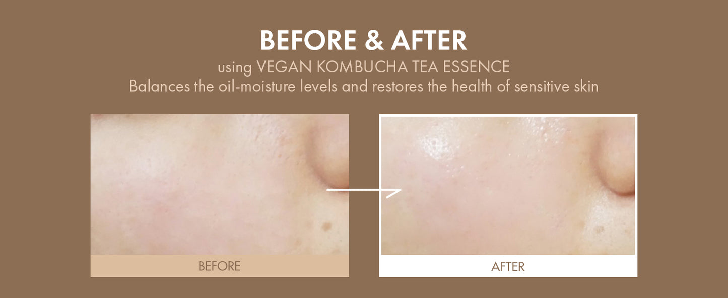 Vegan Kombucha Cream Essence, Cruelty FreeㅣThe most Effective all-in-one serum