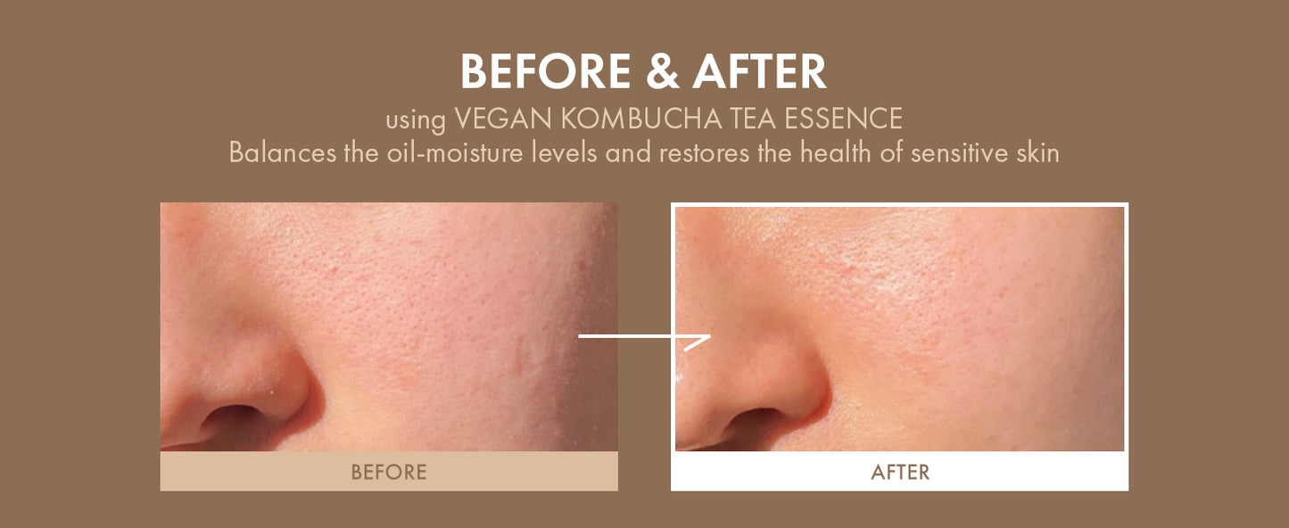 Vegan Kombucha Cream Essence, Cruelty FreeㅣThe most Effective all-in-one serum